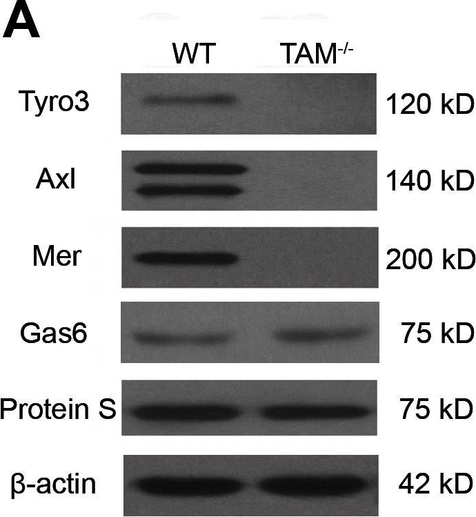 Fig.4.A showing Western Blotting in a Mus musculus (House mouse) sample from the publication: Development of a spontaneous liver disease resembling autoimmune hepatitis in mice lacking tyro3, axl and mer receptor tyrosine kinases.