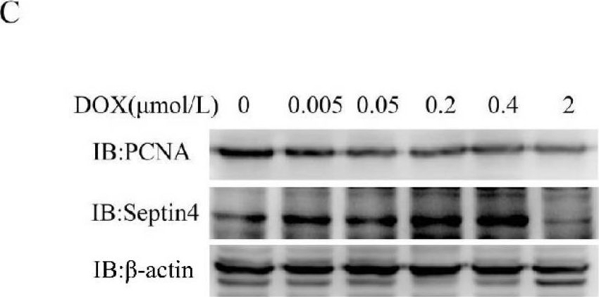 Fig.2.C showing Western Blotting in a Homo sapiens (Human) sample from the publication: Septin4 promotes cell death in human colon cancer cells by interacting with BAX.