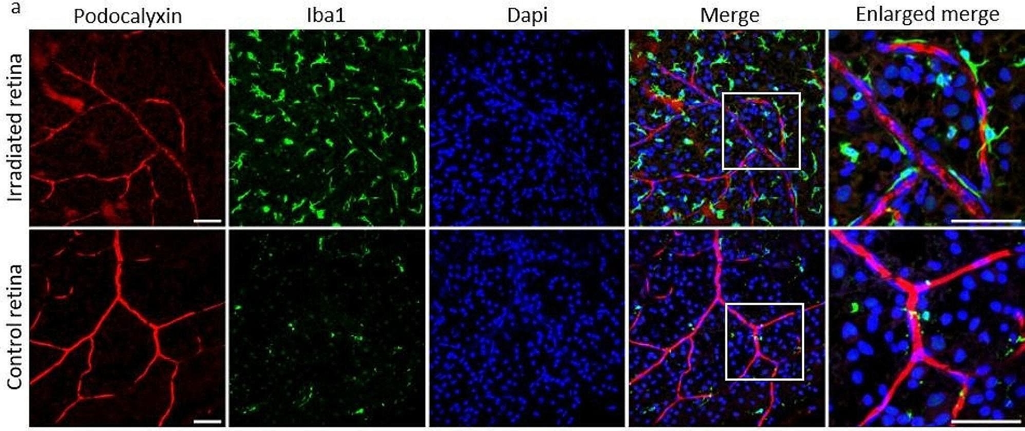Fig.5.A showing Immunohistochemistry-immunofluorescence in a Rattus norvegicus (Rat) sample from the publication: Role of inflammation in a rat model of radiation retinopathy.