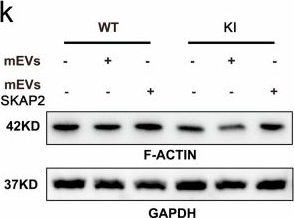 Fig.7.K showing Western Blotting in a Mus musculus (House mouse) sample from the publication: Targeting SKAP2 restores sperm motility and morphology through modulating mitochondrial organization and cytoskeletal remodeling.