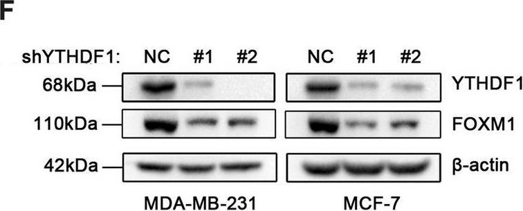 Fig.5.F showing Western Blotting in a Homo sapiens (Human) sample from the publication: YTHDF1 promotes breast cancer progression by facilitating FOXM1 translation in an m6A-dependent manner.