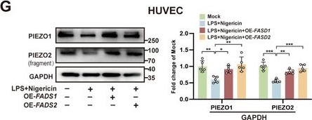 Fig.3.G showing Western Blotting in a Homo sapiens (Human) sample from the publication: Metabolic Interplay in Acute Lung Injury: PARK7 Integrates FADS1/2-Dependent PUFA Metabolism and H3K14 Lactylation to Attenuate Endothelial Ferroptosis and Dysfunction.