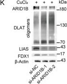 Fig.7.K showing Western Blotting in a Mus musculus (House mouse) sample from the publication: Multi-omics integration identifies ARID1B linking cuproptosis-immune crosstalk with atherosclerotic plaque progression.