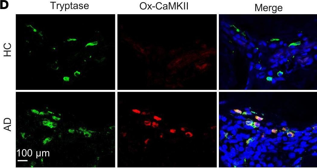 Fig.9.D showing Immunohistochemistry-immunofluorescence in a Homo sapiens (Human) sample from the publication: Dendritic cell immunoreceptor drives atopic dermatitis by modulating oxidized CaMKII-involved mast cell activation.