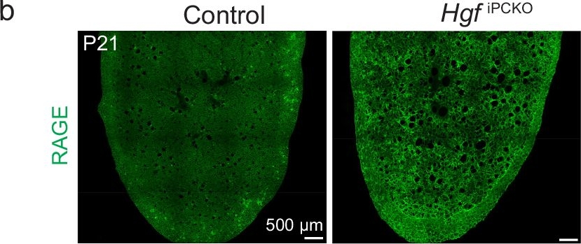 Fig.3.B showing Immunohistochemistry-immunofluorescence in a Mus musculus (House mouse) sample from the publication: Pericytes are organ-specific regulators of tissue morphogenesis.