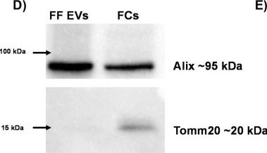 Fig.6.D showing Western Blotting in a Bos taurus (Bovine) sample from the publication: Corpus luteum presence in the bovine ovary increase intrafollicular progesterone concentration: consequences in follicular cells gene expression and follicular fluid small extracellular vesicles miRNA contents.