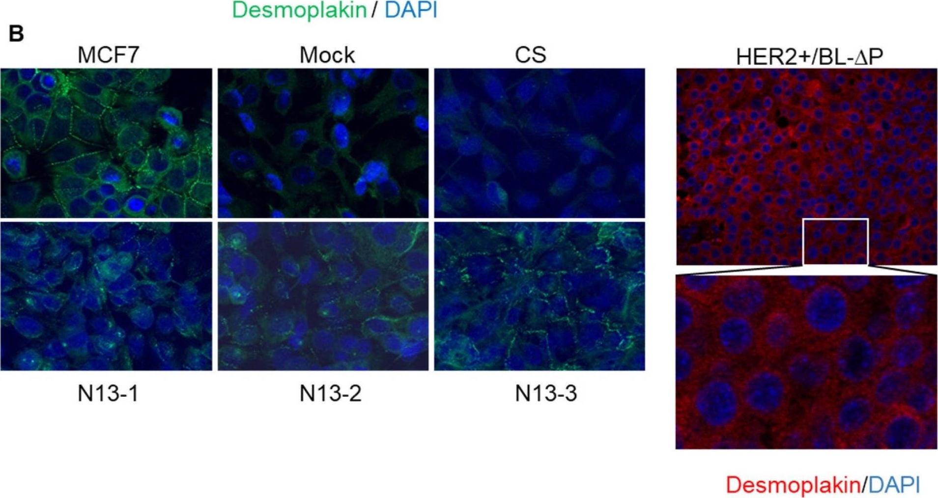 PTPN13 induces cell junction stabilization and inhibits mammary tumor invasiveness.