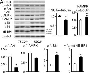 mTOR Hyperactivation by Ablation of Tuberous Sclerosis Complex 2 in the Mouse Heart Induces Cardiac Dysfunction with the Increased Number of Small Mitochondria Mediated through the Down-Regulation of Autophagy.