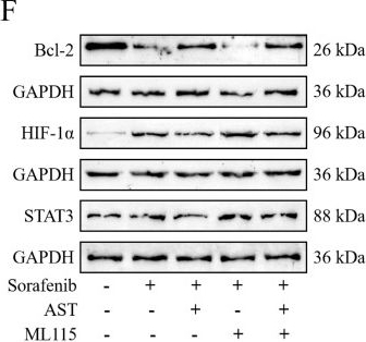 Fig.4.F showing Western Blotting in a Mus musculus (House mouse) sample from the publication: Astragaloside IV Reduces Sorafenib-Induced Cardiotoxicity by Inhibiting Apoptosis Through the STAT3/HIF-1α/Bcl-2 Signaling Pathway.