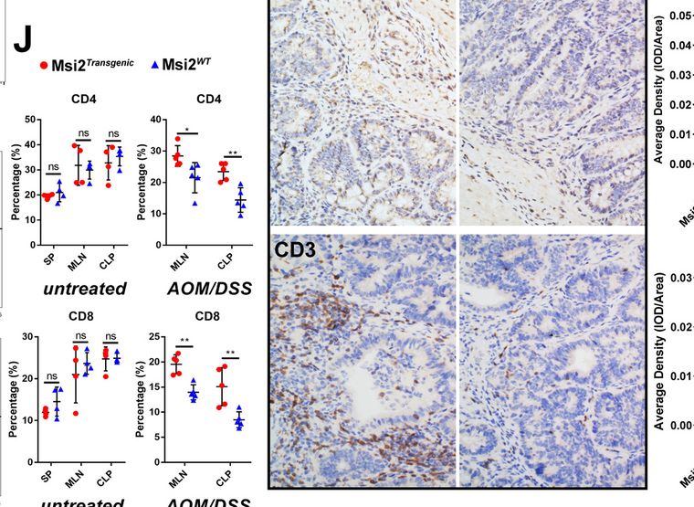 Fig.2.J showing Immunohistochemistry from the publication: Musashi-2 potentiates colorectal cancer immune infiltration by regulating the post-translational modifications of HMGB1 to promote DCs maturation and migration.
