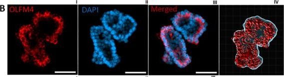 Fig.3.B showing Immunohistochemistry-immunofluorescence from the publication: 3D fluorescence staining and confocal imaging of low amount of intestinal organoids (enteroids): Protocol accessible to all.