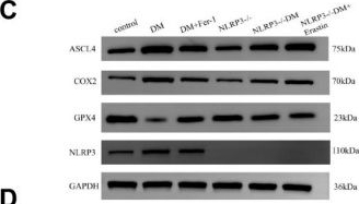 Fig.3.C showing Western Blotting from the publication: NLRP3 Inflammasome Inhibition Attenuates Diabetic Kidney Injury via the Suppression of Ferroptosis: Mechanistic Insights from In Vivo and In Vitro Models.