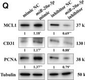 Fig.5.Q showing Western Blotting from the publication: LncRNA CACF promotes autophagy and cardiac recovery after myocardial infarction by targeting ATG7.