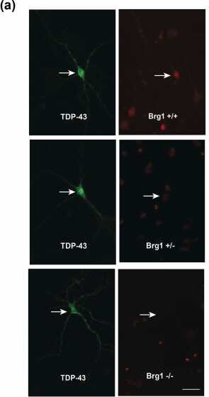 Fig.8.A showing Immunocytochemistry-immunofluorescence from the publication: Impact of histone deacetylase inhibition and arimoclomol on heat shock protein expression and disease biomarkers in primary culture models of familial ALS.