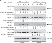 Fig.6.A showing Western Blotting from the publication: Biallelic JAK1 mutations in immunodeficient patient with mycobacterial infection.