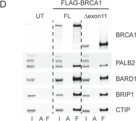 Fig.1.D showing Western Blotting from the publication: An Inducible BRCA1 Expression System with In Vivo Applicability Uncovers Activity of the Combination of ATR and PARP Inhibitors to Overcome Therapy Resistance.