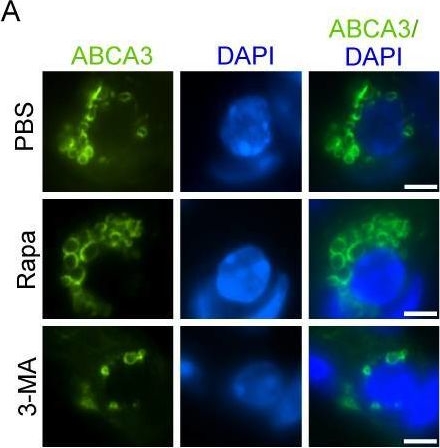 ABCA3 antibodies - Antibody search engine - CiteAb
