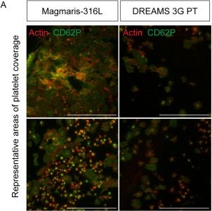 Fig.2.A showing Immunocytochemistry-immunofluorescence in a Homo sapiens (Human) sample from the publication: A novel stent flow chamber system demonstrates reduced thrombogenicity of bioresorbable magnesium scaffolds.