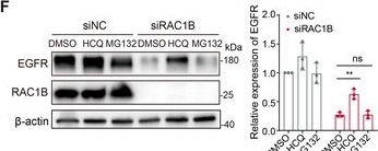 Fig.4.F showing Western Blotting in a Homo sapiens (Human) sample from the publication: Splicing Shift of RAC1 Accelerates Tumorigenesis and Defines a Potent Therapeutic Target in Lung Cancer.
