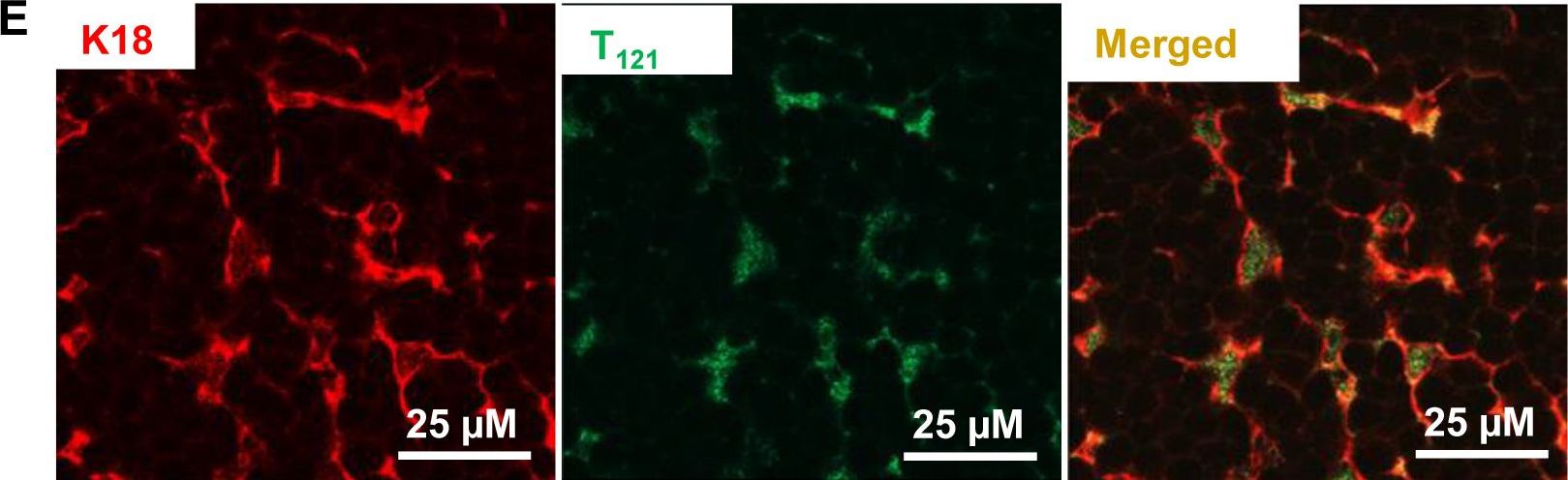 RB inactivation in keratin 18 positive thymic epithelial cells promotes non-cell autonomous T cell hyperproliferation in genetically engineered mice.