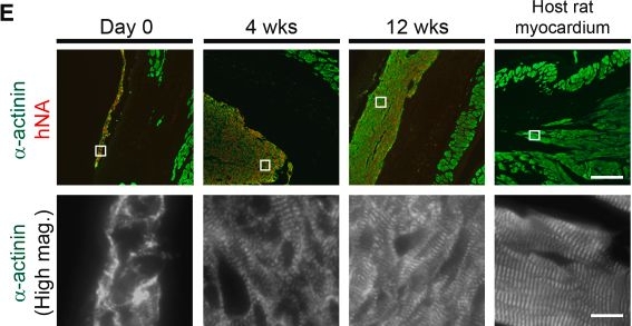 Fig.1.E showing Immunohistochemistry-immunofluorescence in a Homo sapiens (Human) sample from the publication: Human iPSC cardiomyocyte patch transplantation modifies extracellular matrix and fibroblast behavior after myocardial infarction.