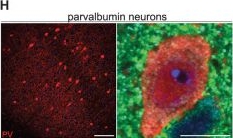 Fig.4.H showing Immunohistochemistry-immunofluorescence in a Mus musculus (House mouse) sample from the publication: Contrasting contribution of resident and repopulated brain macrophages in sustaining sleep-wake circuitry.