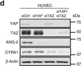 Fig.5.D showing Western Blotting from the publication: A LATS biosensor screen identifies VEGFR as a regulator of the Hippo pathway in angiogenesis.