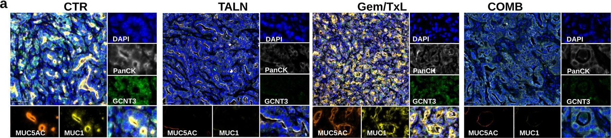 Fig.6.A showing Immunohistochemistry-immunofluorescence in a Mus musculus (House mouse) sample from the publication: Talniflumate abrogates mucin immune suppressive barrier improving efficacy of gemcitabine and nab-paclitaxel treatment in pancreatic cancer.