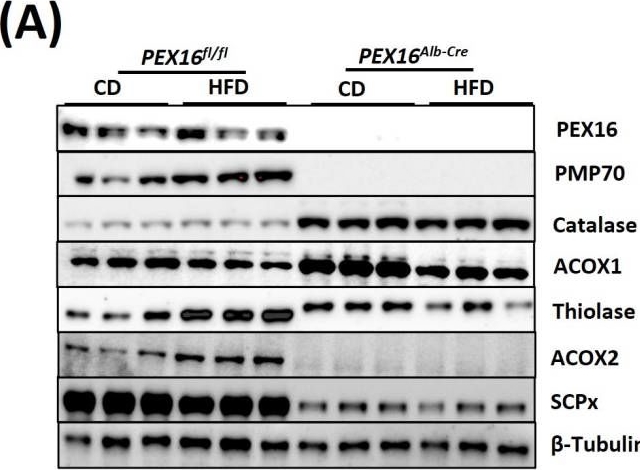 Fig.5.A showing Western Blotting from the publication: Hepatocyte-Specific PEX16 Abrogation in Mice Leads to Hepatocyte Proliferation, Alteration of Hepatic Lipid Metabolism, and Resistance to High-Fat Diet (HFD)-Induced Hepatic Steatosis and Obesity.