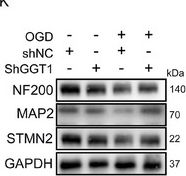 Fig.2.N showing Western Blotting from the publication: "Membrane-Guided" Repair Strategy: Precision Delivery of GGT1 Degrader for Targeted Repair and Regeneration of Spinal Cord Neurons.