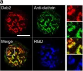 Fig.5.A showing Immunohistochemistry-immunofluorescence from the publication: Integrin-beta3 clusters recruit clathrin-mediated endocytic machinery in the absence of traction force.