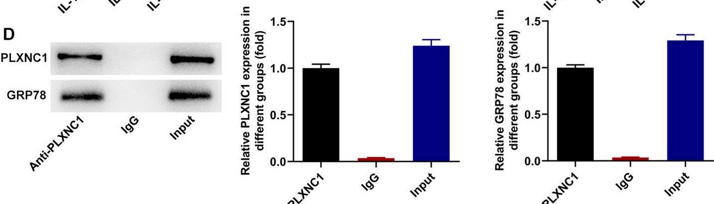 Fig.4.D showing Western Blotting in a Homo sapiens (Human) sample from the publication: PLXNC1 interference alleviates the inflammatory injury, apoptosis and extracellular matrix degradation of IL-1β-exposed chondrocytes via suppressing GRP78 expression.