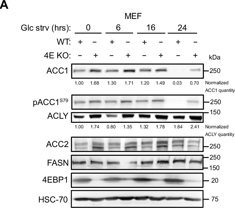 Fig.4.A showing Western Blotting in a Homo sapiens (Human) sample from the publication: mTORC1 regulates cell survival under glucose starvation through 4EBP1/2-mediated translational reprogramming of fatty acid metabolism.