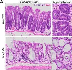 Fig.4.A showing Immunohistochemistry in a Mus musculus (House mouse) sample from the publication: Injury-induced intestinal stem cell renewal requires capillary morphogenesis gene 2.