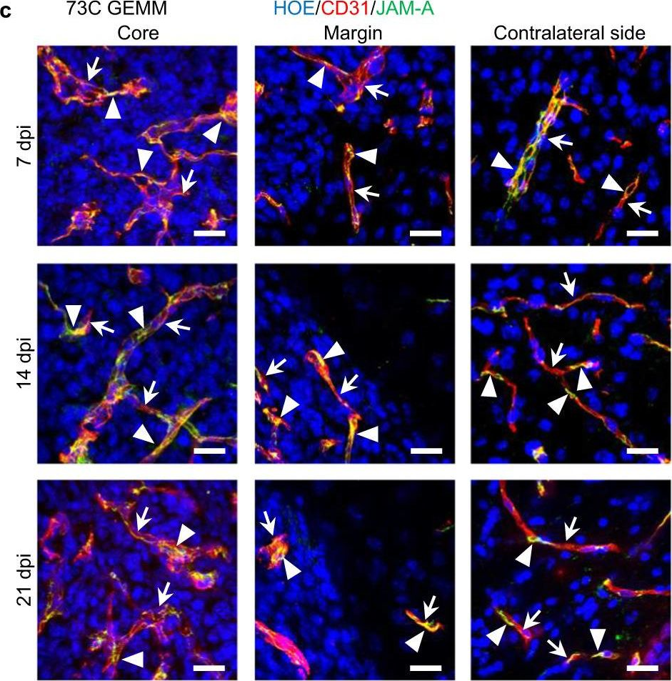 Fig.2.C showing Immunohistochemistry in a Mus musculus (House mouse) sample from the publication: Optical blood-brain-tumor barrier modulation expands therapeutic options for glioblastoma treatment.