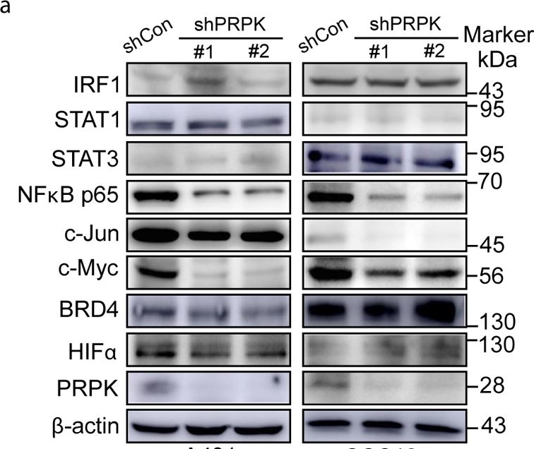 Fig.4.A showing Western Blotting in a Homo sapiens (Human) sample from the publication: Deletion of p53-Related Protein Kinase Suppresses Solar UV-Induced Photocarcinogenesis by Inhibiting PD-L1 Expression and Enhancing CD8 T-Cell Infiltration.