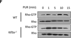 Fig.1.F showing Western Blotting from the publication: Activation of the Gi protein-RHOA axis by non-canonical Hedgehog signaling is independent of primary cilia.