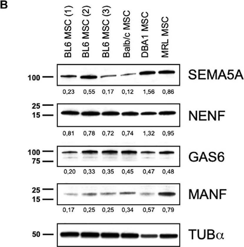 Fig.4.B showing Western Blotting from the publication: MANF Produced by MRL Mouse-Derived Mesenchymal Stem Cells Is Pro-regenerative and Protects From Osteoarthritis.