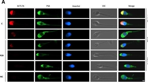 Fig.3.A showing Immunocytochemistry-immunofluorescence in a Homo sapiens (Human) sample from the publication: High rate of detected variants in male PLCZ1 and ACTL7A genes causing failed fertilization after ICSI.