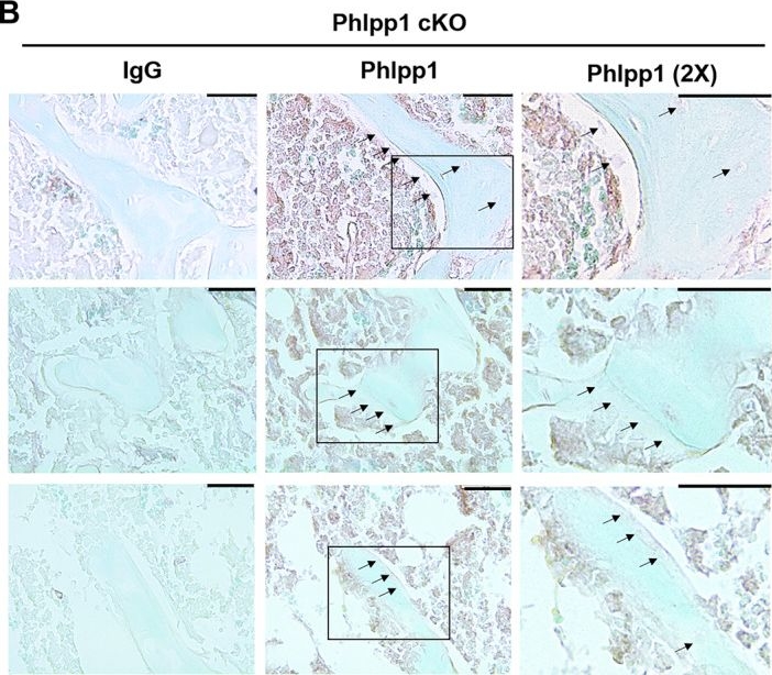 Fig.4.B showing Immunohistochemistry in a Mus musculus (House mouse) sample from the publication: Phlpp1 Expression in Osteoblasts Plays a Modest Role in Bone Homeostasis.