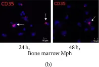 Fig.10.B showing Immunocytochemistry-immunofluorescence in a Mus musculus (House mouse) sample from the publication: Differences between Mycobacterium-Host Cell Relationships in Latent Tuberculous Infection of Mice Ex Vivo and Mycobacterial Infection of Mouse Cells In Vitro.