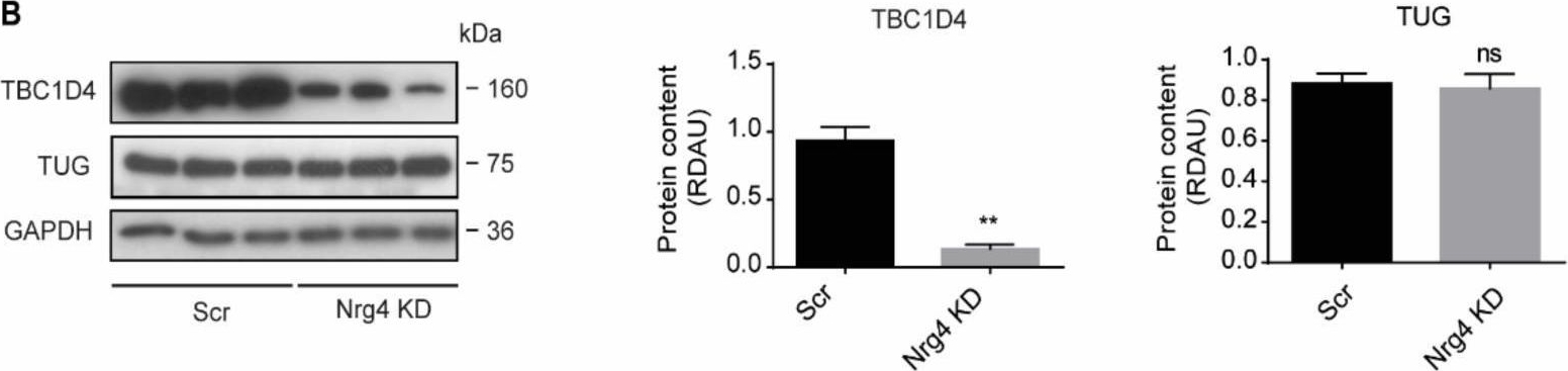 Fig.7.B showing Western Blotting in a Mus musculus (House mouse) sample from the publication: Neuregulin 4 Downregulation Induces Insulin Resistance in 3T3-L1 Adipocytes through Inflammation and Autophagic Degradation of GLUT4 Vesicles.
