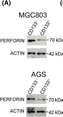 Fig.5.A showing Western Blotting in a Mus musculus (House mouse) sample from the publication: Cholesterol-regulated cellular stiffness may enhance evasion of NK cell-mediated cytotoxicity in gastric cancer stem cells.