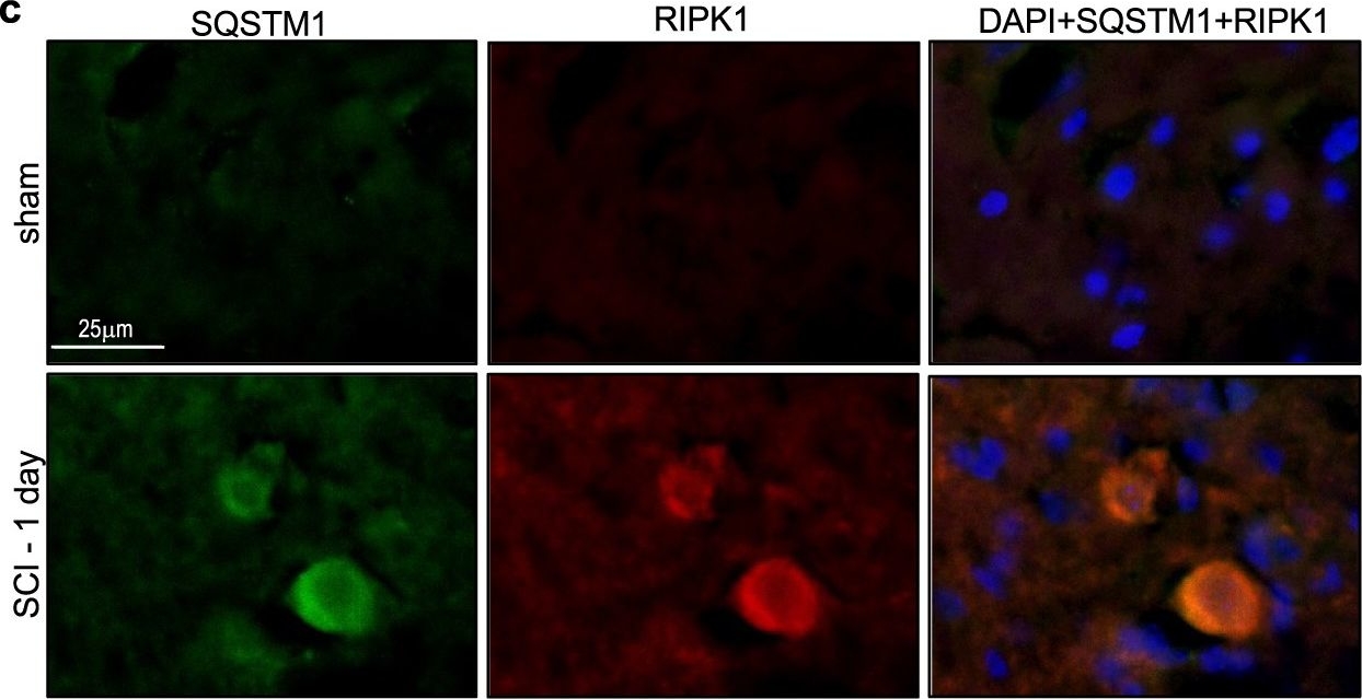 Lysosomal damage after spinal cord injury causes accumulation of RIPK1 and RIPK3 proteins and potentiation of necroptosis.