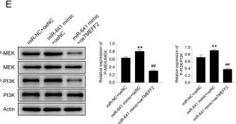 Fig.4.E showing Western Blotting in a Homo sapiens (Human) sample from the publication: MiR-641 targets TMEFF2/MEK/PI3K to promote stem cell characteristics of pancreatic cancer cells.