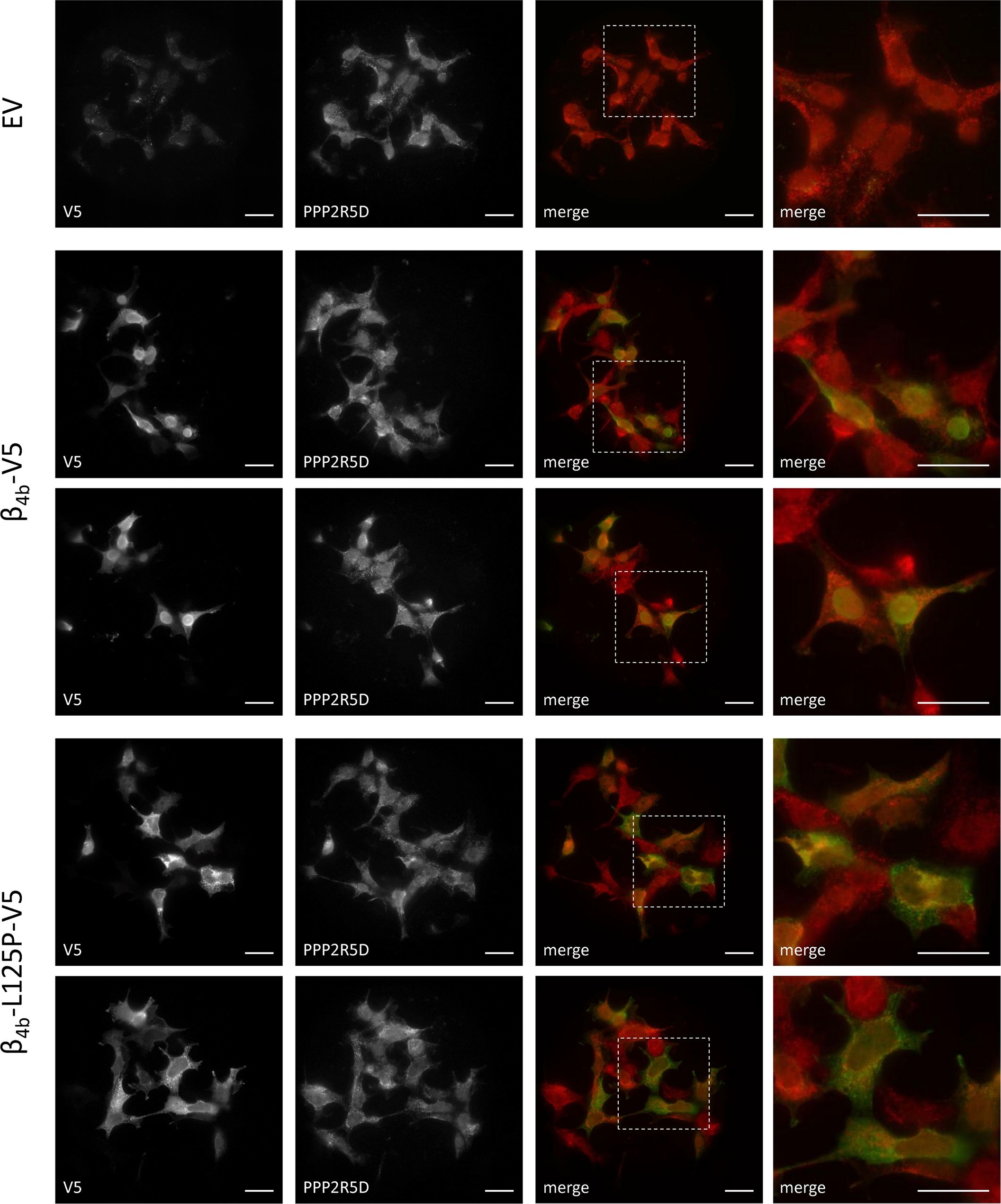 Fig.6.A showing Immunocytochemistry in a Homo sapiens (Human) sample from the publication: A homozygous missense variant in CACNB4 encoding the auxiliary calcium channel beta4 subunit causes a severe neurodevelopmental disorder and impairs channel and non-channel functions.