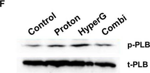 Fig.3.F showing Western Blotting from the publication: Effects of Proton Therapy on Cardiac Fibrosis, Calcium Homeostasis, and AQP4 Expression in Hypergravity-Exposed Rats.