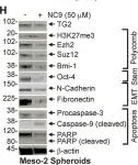 Fig.4.H showing Western Blotting in a Mus musculus (House mouse) sample from the publication: Transglutaminase is a mesothelioma cancer stem cell survival protein that is required for tumor formation.
