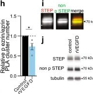 Fig.6.H showing Western Blotting from the publication: VEGFD signaling balances stability and activity-dependent structural plasticity of dendrites.