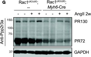 Fig.8.G showing Western Blotting from the publication: Rac1 palmitoylation is required for cardiac stress adaptation and regulation of protein kinase A signaling.